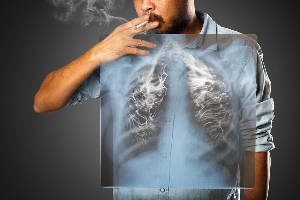 kajenje škodljivo vpliva na človeško telo